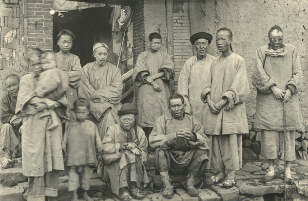 A group, including lepers