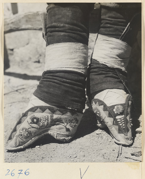Woman with bound feet wearing embroidered shoes in the Lost Tribe country