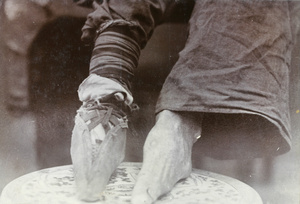 Bound feet and shoe